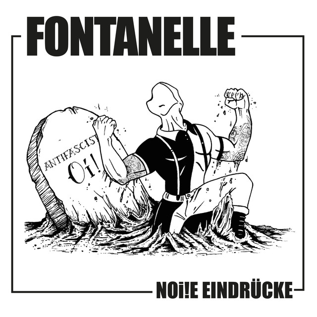 Fontanelle