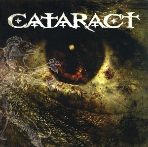 Cataract