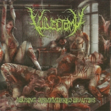 Vulvectomy - Abusing Dismembered Beauties '2013