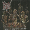 Mindly Rotten - The Most Exquisite Agonies '2005